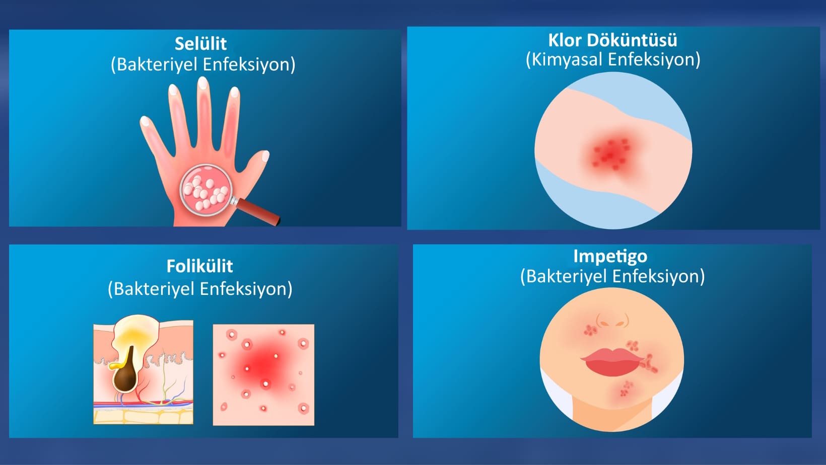 resihavuzdan-kapilan-enfeksiyonlar-ve-tedavi-yontemleri